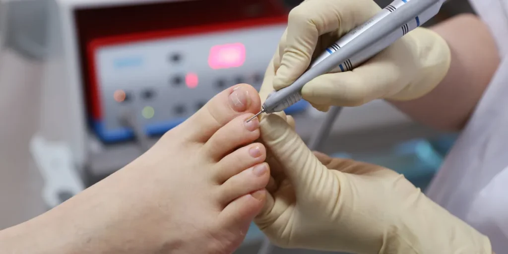 home remedies for ingrown toenail